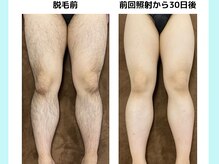 アリア 新小岩(Aria)の雰囲気（1回の照射でも効果を実感していただけます。※個人差あります。）