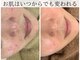 リノ(Lino)の写真