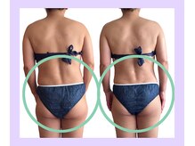 ヨサパーク コクリ(YOSA PARK kokuRi)/腰回りスッキリ！痩身/毛穴/小顔