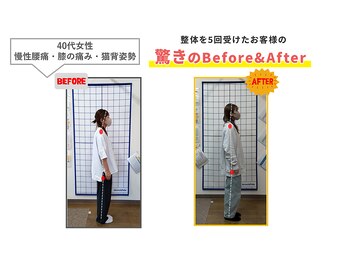 にこにこ整体 整骨院/【腰痛・猫背矯正】整体をBE⇒AF