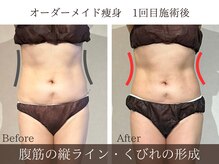 サロン オオドオリ(SALON ODORI)の雰囲気（札幌エステ/リンパマッサージ/フェイシャル/小顔/首肩こり/腰痛）