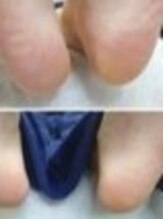 リゼラアンドコー 盛岡店/ドイツ式フットケア専門店