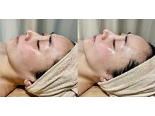 サロン ド ブラン アオヤマ(Salon de BLANC AOYAMA)/