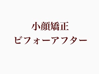 クロア ナゴヤ(Croire NAGOYA)/小顔矯正ビフォーアフター集