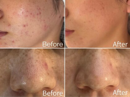 フレキシ 表参道(Flexi)の写真