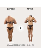 ビループ(biloop)/感動の結果をお見せします。