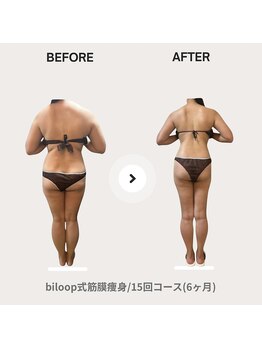 ビループ(biloop)/感動の結果をお見せします。