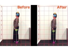 ケアルーム 湘南台(CARE room)/施術効果写真☆（before after）