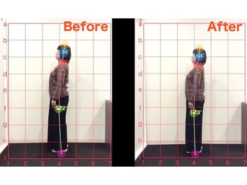 ケアルーム 湘南台(CARE room)/施術効果写真☆(before after)