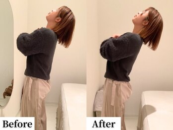 ソレア(Solea)/腰痛改善