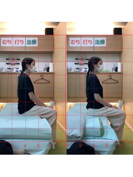 よし鍼灸接骨院 南堀江院/骨盤矯正/マッサージ整体/鍼灸