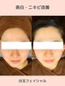 【美白肌】SNSで超話題☆極上白玉フェイシャル