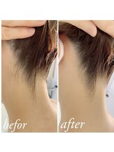 ティアル 赤坂(tiarl)/うなじシェービング