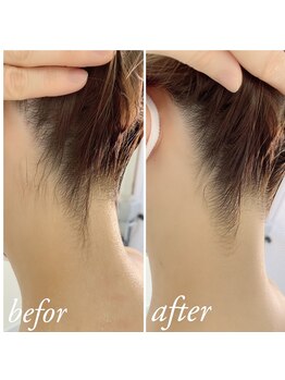 ティアル 赤坂(tiarl)/うなじシェービング