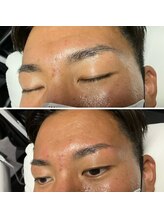眉毛男子 新宿店/お客様の施術例【新宿店】