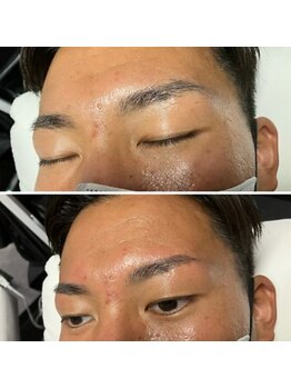 眉毛男子 新宿店/お客様の施術例【新宿店】