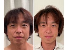 美人バスト 札幌店/小顔コルギ◇症例◇バストアップ