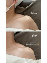 フェリーチェ(felice)/beforeafter