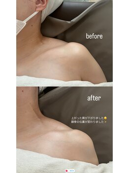 フェリーチェ(felice)/beforeafter