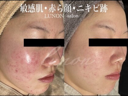 ルノン(Lunon)の写真