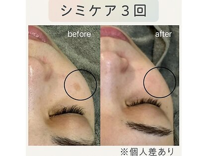 ラテ(Latte)の写真
