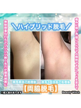 ビューティ ウィッチ(Beauty Witch)/