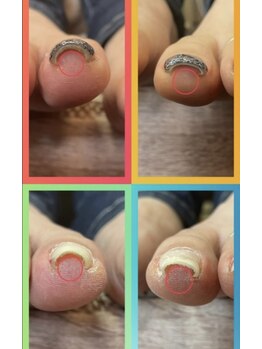 アイラスジュニア(AILAS.Jr)/