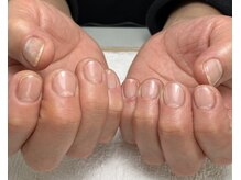 ブルーム(Bloom)/クリアワンカラー