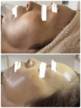 サロンニーナ(Salon.Nina)/韓国肌管理セルマン