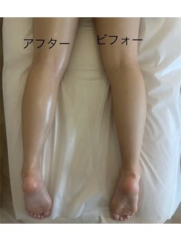 ビ フェイス(Bi-face)/足のむくみ、わずか15分!