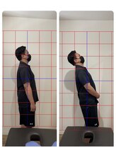 みなくち整骨院/肩こり・腰痛改善コース