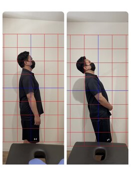 みなくち整骨院/肩こり・腰痛改善コース