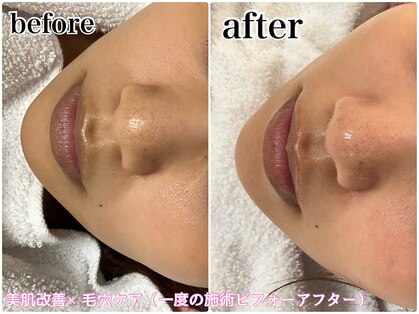 ルモエクラ(LUMO Eclat)の写真
