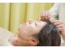 人気の美容鍼&小顔矯正マッサージ　モニター募集中　