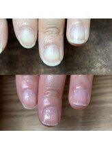 リリ(lili)/ハンドトータルケア/ネイルケア