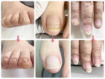 爪処 中野坂上/トラブル爪