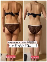 ヨサパーク ハット(YOSA PARK HAT)/1ヶ月で小尻に！