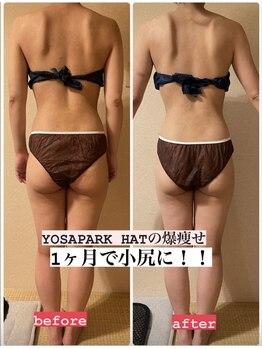 ヨサパーク ハット(YOSA PARK HAT)/1ヶ月で小尻に!