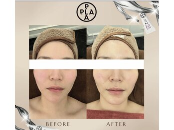 エミア(Emia)/韓国発☆プラチナ・プラピール