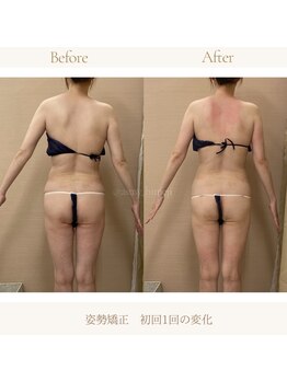 アスミー/ハップル 姫路店(Asmy/happle)/初回施術1回でここまでの変化