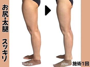 ミロク178式プロデュース(MIROKU178式プロデュース)/オールハンド施術