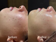 ディアーム 光明池店(Diarm)/