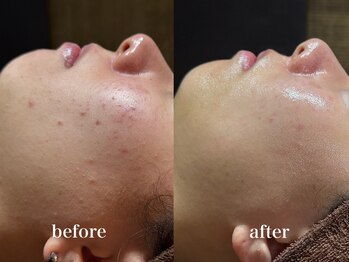 ディアーム 光明池店(Diarm)/