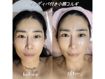 ホグシ ヒロオ(HOGUSHI HIRO-O)の写真