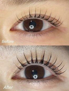 エーラッシュ(A-Lash)/いく毛のビフォー&アフター
