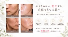 リノマ(LINOMA)