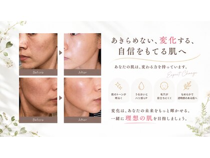 リノマ(LINOMA)の写真