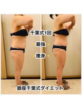 ヒーリングユー(Healing you)/５０代ビフォーアフター