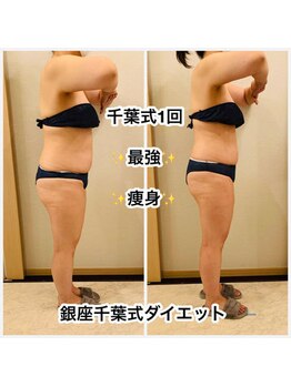 ヒーリングユー(Healing you)/５０代ビフォーアフター