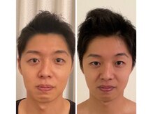 美人バスト 札幌店/小顔コルギ◇症例◇バストアップ